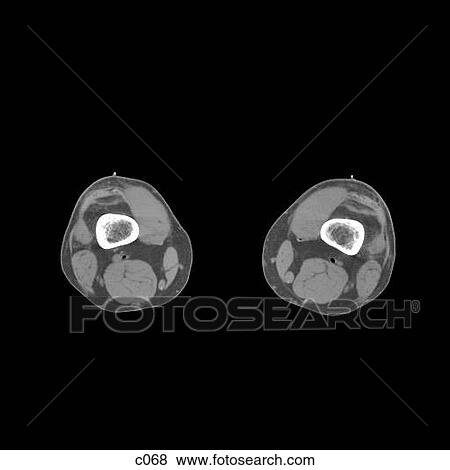 Stock Illustration - Legs - Feet. Fotosearch