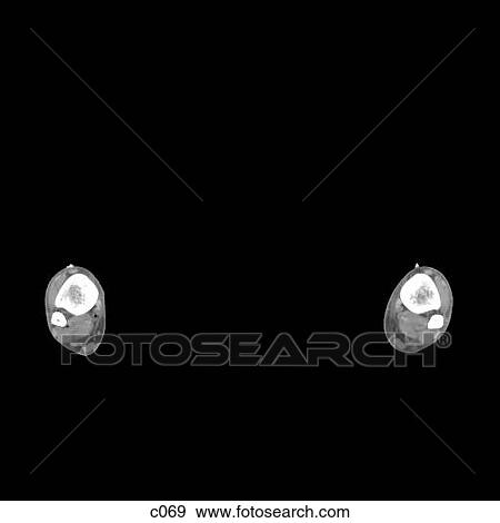 Stock Illustration - Legs - Feet. Fotosearch