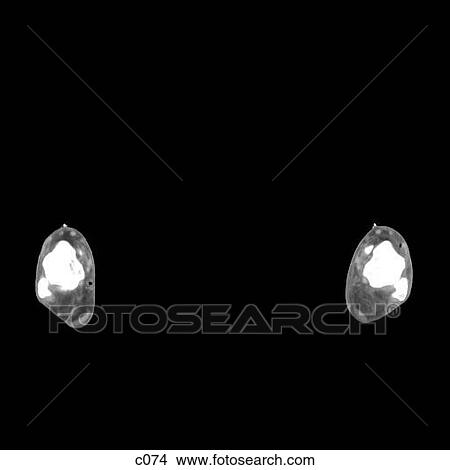 Stock Illustration - Legs - Feet. Fotosearch