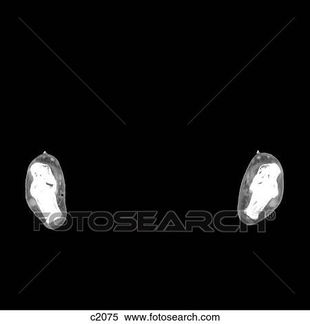 Stock Illustration - Legs - Feet. Fotosearch
