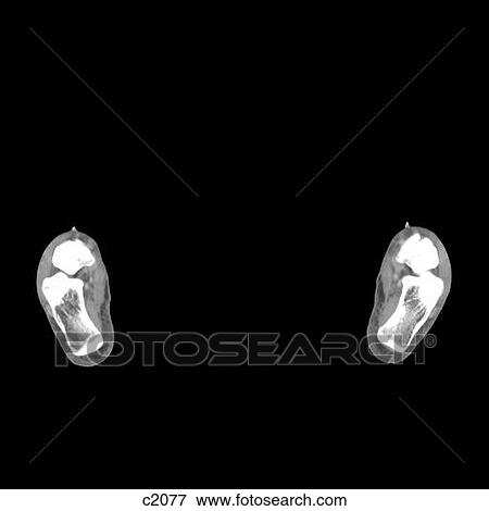 Stock Illustration - Legs - Feet. Fotosearch