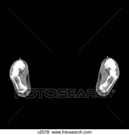 Legs - Feet View Large Illustration Stock Illustration - Legs - Feet. Fotosearch