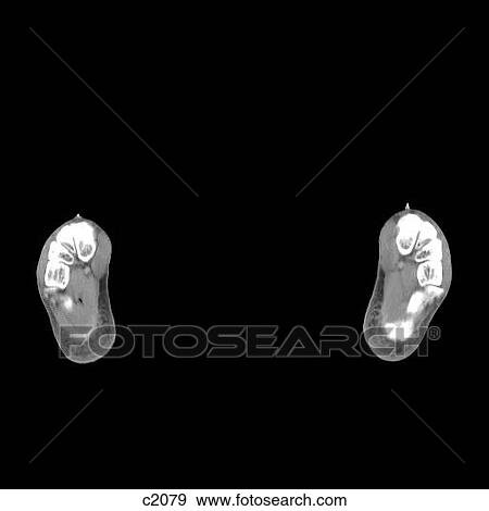 Stock Illustration - Legs - Feet. Fotosearch