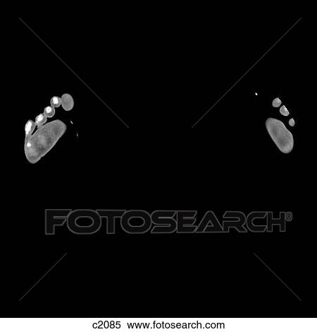Stock Illustration - Legs - Feet. Fotosearch