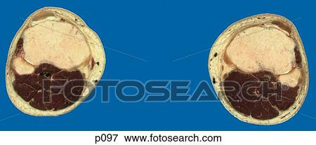 Legs - Feet View Large Illustration Stock Illustration - Legs - Feet. Fotosearch