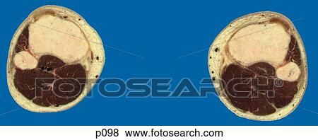 Legs - Feet View Large Illustration Stock Illustration - Legs - Feet. Fotosearch