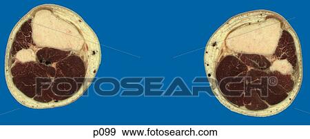 Stock Illustration - Legs - Feet. Fotosearch