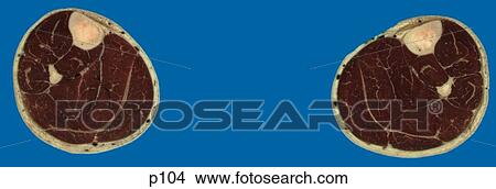 Stock Illustration - Legs - Feet. Fotosearch