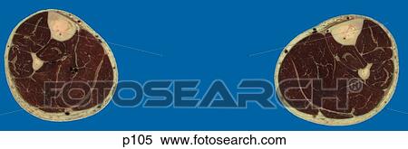 Stock Illustration - Legs - Feet. Fotosearch