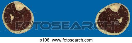Stock Illustration - Legs - Feet. Fotosearch