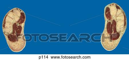 Stock Illustration - Legs - Feet. Fotosearch