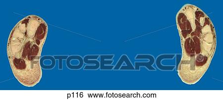 Stock Illustration - Legs - Feet. Fotosearch