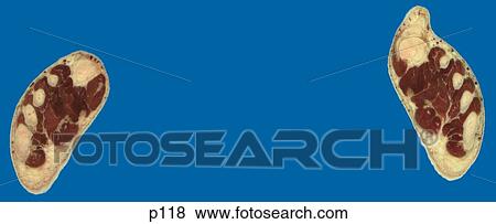 Stock Illustration - Legs - Feet. Fotosearch