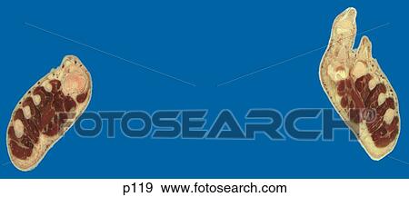 Legs - Feet View Large Illustration Stock Illustration - Legs - Feet. Fotosearch