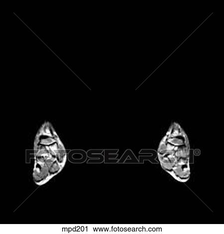 Lower Legs and Feet - Coronal View Large Illustration Clip Art - Lower Legs and Feet - Coronal. Fotosearch