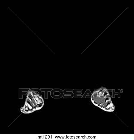 Lower Legs and Feet - Coronal View Large Illustration Clip Art - Lower Legs and Feet - Coronal. Fotosearch