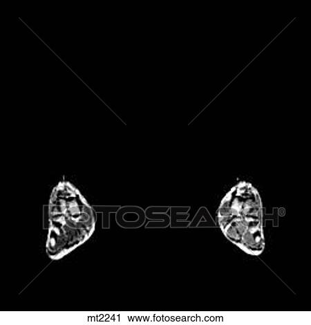 Lower Legs and Feet - Coronal View Large Illustration Clip Art - Lower Legs and Feet - Coronal. Fotosearch