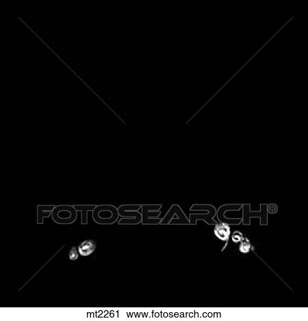 Lower Legs and Feet - Coronal View Large Illustration Clip Art - Lower Legs and Feet - Coronal. Fotosearch