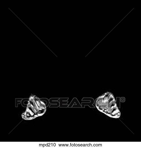 Lower Legs and Feet - Coronal View Large Illustration Clipart - Lower Legs and Feet - Coronal. Fotosearch
