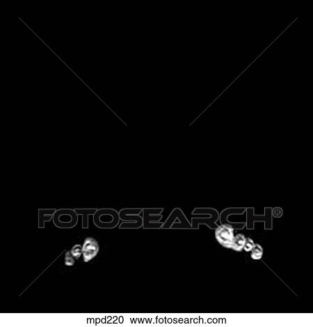 Lower Legs and Feet - Coronal View Large Illustration Clipart - Lower Legs and Feet - Coronal. Fotosearch