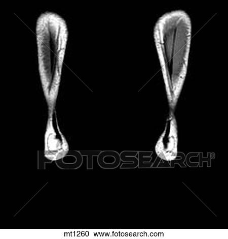 Lower Legs and Feet - Coronal View Large Illustration Clipart - Lower Legs and Feet - Coronal. Fotosearch