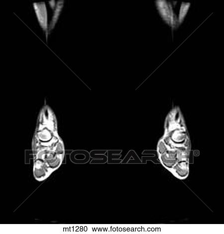 Lower Legs and Feet - Coronal View Large Illustration Clipart - Lower Legs and Feet - Coronal. Fotosearch