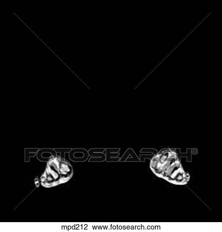 Lower Legs and Feet - Coronal View Large Illustration Drawing - Lower Legs and Feet - Coronal. Fotosearch