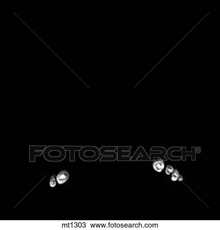 Lower Legs and Feet - Coronal View Large Illustration Drawing - Lower Legs and Feet - Coronal. Fotosearch