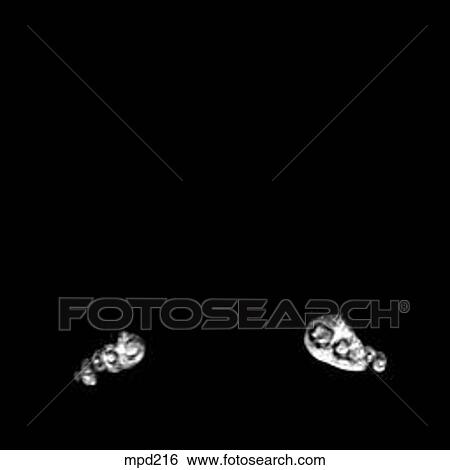 Lower Legs and Feet - Coronal View Large Illustration Stock Illustration - Lower Legs and Feet - Coronal. Fotosearch