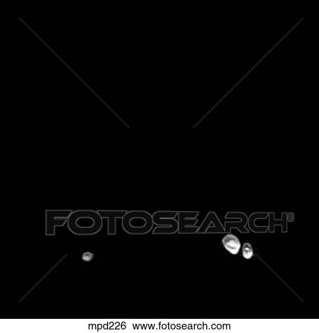 Lower Legs and Feet - Coronal View Large Illustration Stock Illustration - Lower Legs and Feet - Coronal. Fotosearch