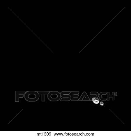 Stock Illustration - Lower Legs and Feet - Coronal. Fotosearch