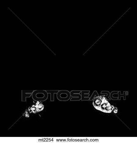 Lower Legs and Feet - Coronal View Large Illustration Stock Illustration - Lower Legs and Feet - Coronal. Fotosearch