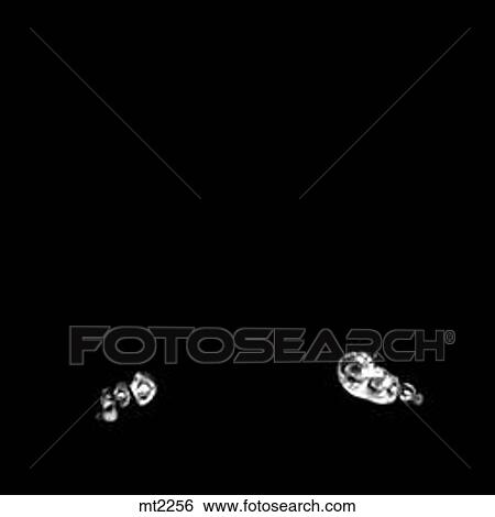 Stock Illustration - Lower Legs and Feet - Coronal. Fotosearch