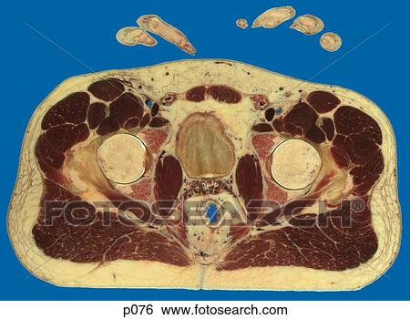 Stock Illustration - Pelvis. Fotosearch