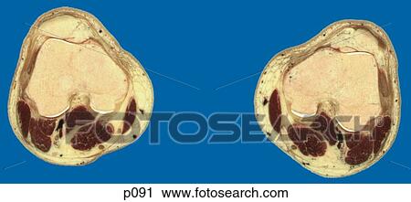 Thighs - Knee View Large Illustration Clip Art - Thighs - Knee. Fotosearch