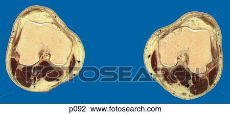 Drawing - Thighs - Knee. Fotosearch