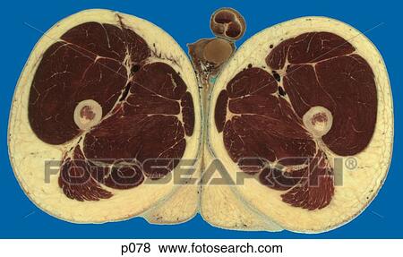 Stock Illustration - Thighs - Knee. Fotosearch
