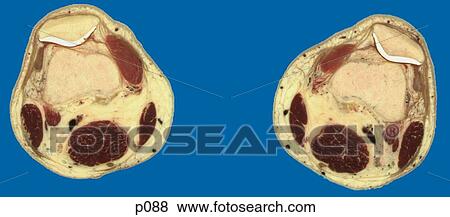 Thighs - Knee View Large Illustration Stock Illustration - Thighs - Knee. Fotosearch