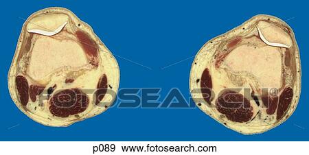 Thighs - Knee View Large Illustration Stock Illustration - Thighs - Knee. Fotosearch