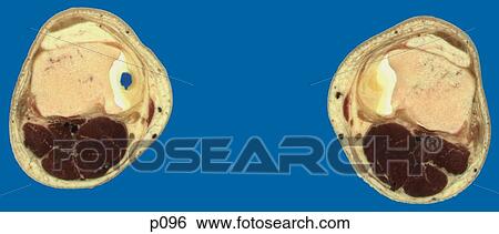 Thighs - Knee View Large Illustration Stock Illustration - Thighs - Knee. Fotosearch