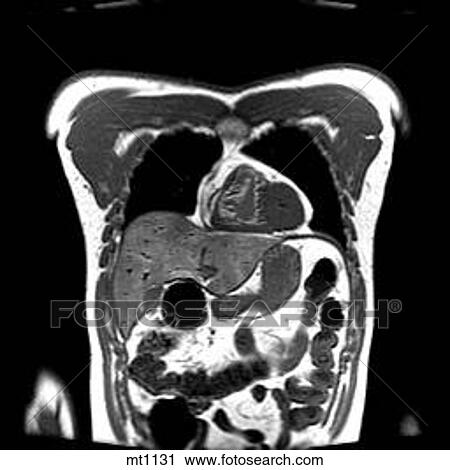 Thorax - Coronal View Large Illustration Clip Art - Thorax - Coronal. Fotosearch