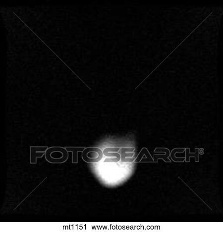 Thorax - Coronal View Large Illustration Clip Art - Thorax - Coronal. Fotosearch