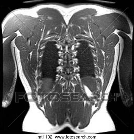 Thorax - Coronal View Large Illustration Drawing - Thorax - Coronal. Fotosearch