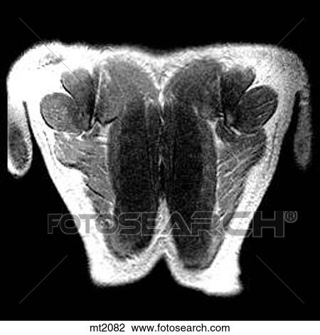 Thorax - Coronal View Large Illustration Drawing - Thorax - Coronal. Fotosearch