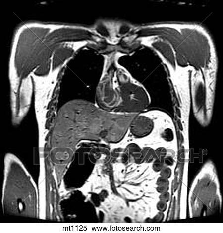 Stock Illustration - Thorax - Coronal. Fotosearch