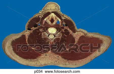 Thorax View Large Illustration Stock Illustration - Thorax. Fotosearch
