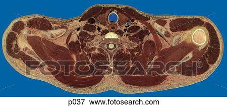 Thorax View Large Illustration Stock Illustration - Thorax. Fotosearch