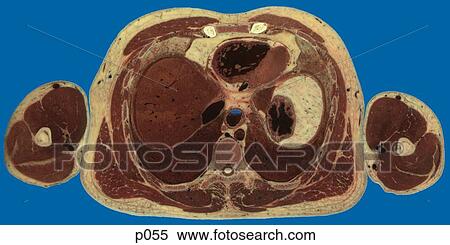 Thorax View Large Illustration Stock Illustration - Thorax. Fotosearch