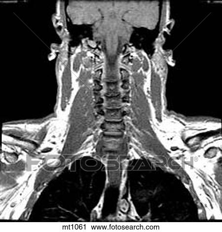 Upper Body - Coronal View Large Illustration Clip Art - Upper Body - Coronal. Fotosearch