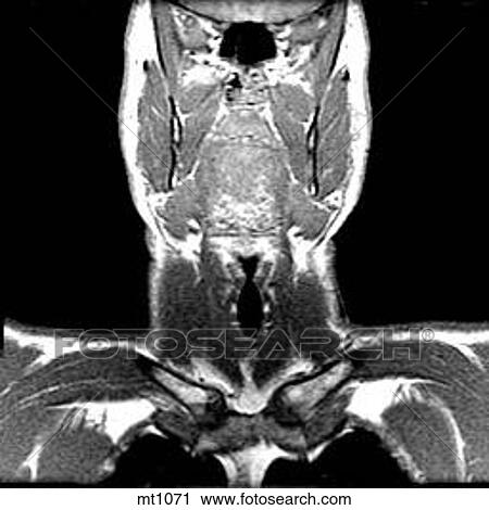 Upper Body - Coronal View Large Illustration Clip Art - Upper Body - Coronal. Fotosearch